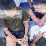 santri dibakar - ilustrasi berita KPAI: Keluarga santri dibakar terkendala biaya untuk berobat di Lombok Tengah