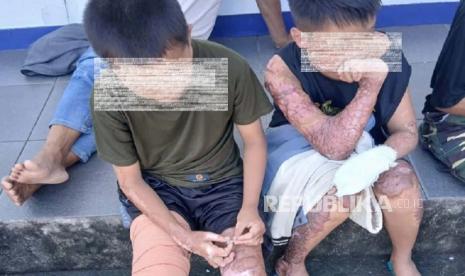 santri dibakar - ilustrasi berita KPAI: Keluarga santri dibakar terkendala biaya untuk berobat di Lombok Tengah