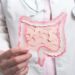makanan sehat usus - ilustrasi berita Bagus buat Diet! Ini 7 Makanan Sehat Usus versi Dokter Harvard